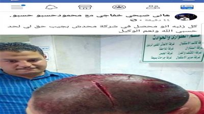 إصابة محصل بإيرادات المرج بعدة طعنات وجروح متفرقه